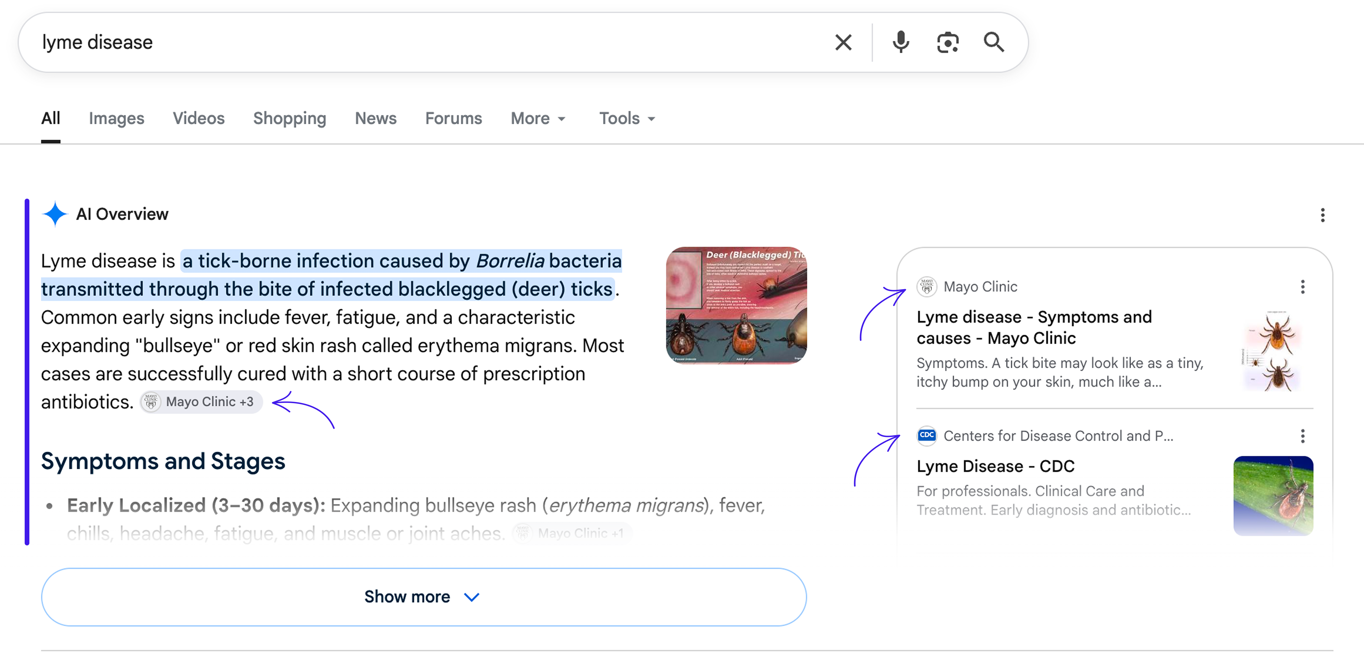Capture d'écran d'une page de résultats Google montrant un Aperçu IA : un résumé généré par IA qui répond à la requête, affiché au-dessus des résultats en liens bleus classiques